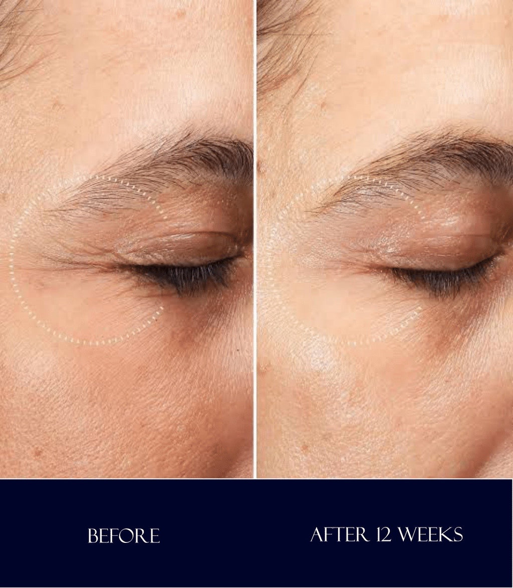 AsmaCharlotte Retinal Anti-Wrinkles Eye Cream